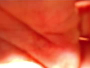 Nude man sextwinksx image #4446201