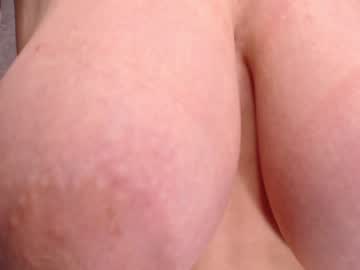 Nude girl incrediblyomelia image #2949796